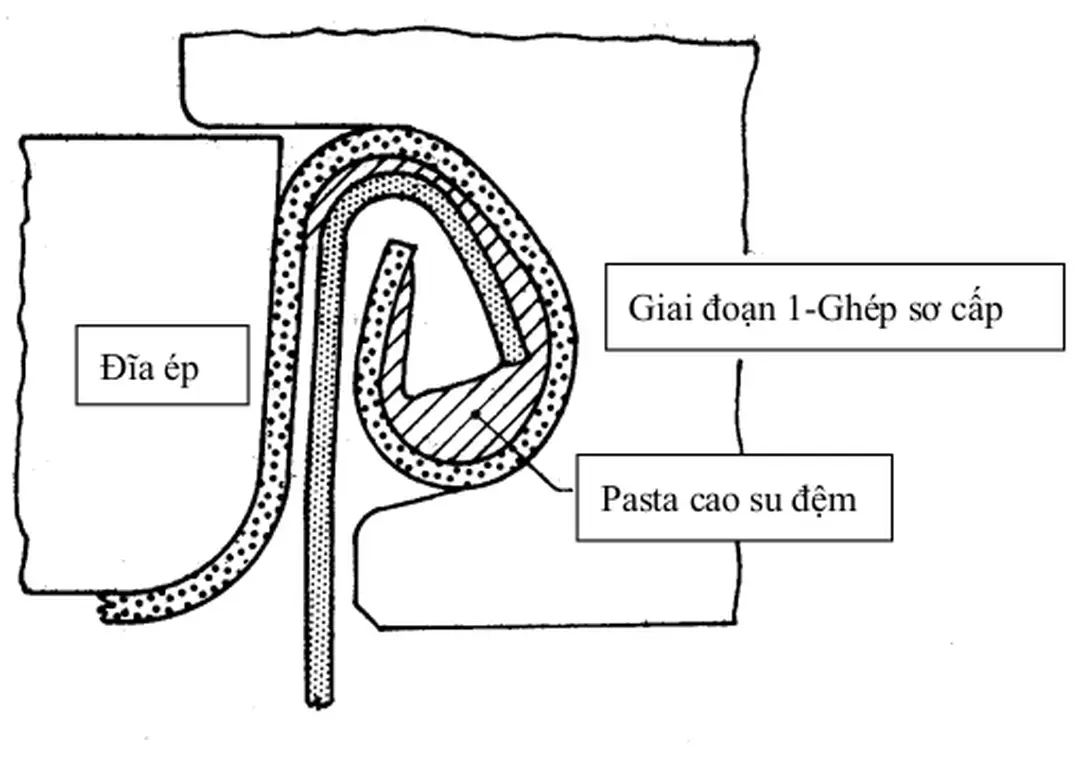 Hình 6: Mặt cắt biểu diễn mí ghép đôi sau khi thực hiện giai đoạn 1 Giai đoạn ghép sơ bộ