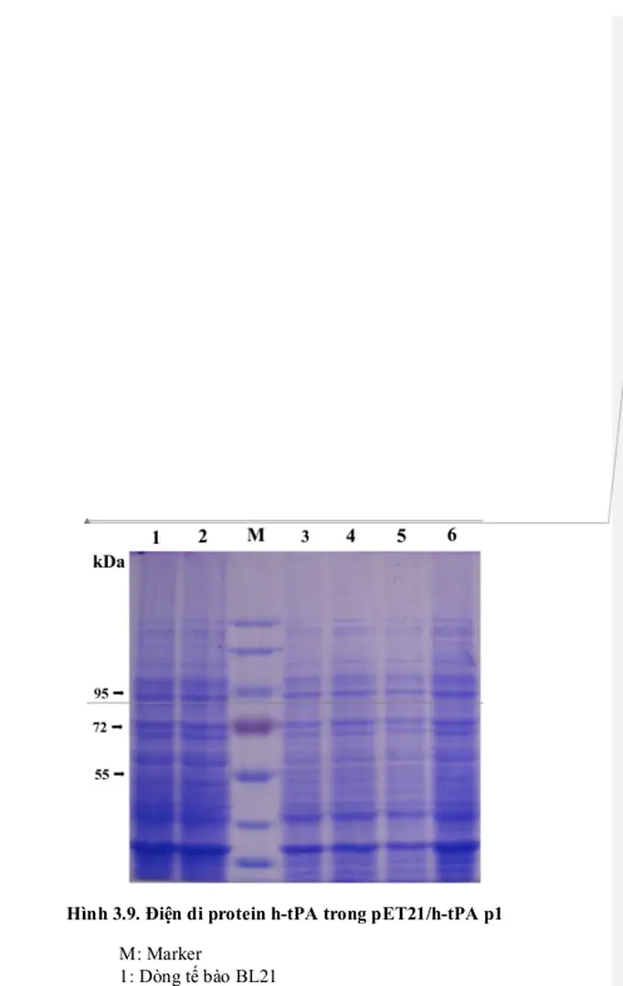 Hình 3.9. Điện di protein h-tPA trong pET21/h-tPA p1 