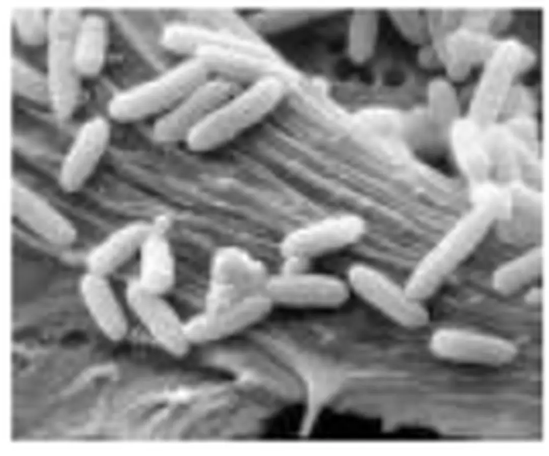 Hình 1: Escherichia Coli