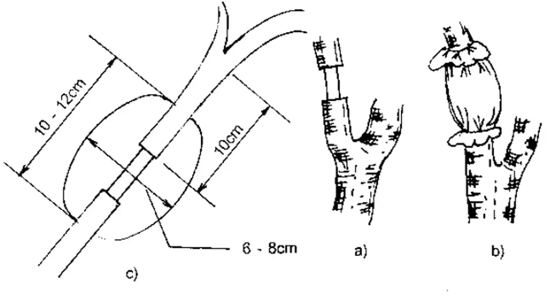 Hình 6.  Ph−ơng pháp chiết nhãn